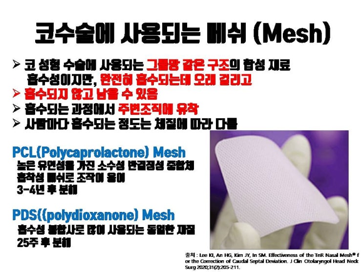  코수술 시 메쉬가 좋은 재료라고요? 천만에 말씀이죠. 코수술 부작용 높이는 이물질에 불과하죠.