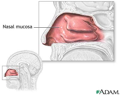 콧물, 비루, Rhinorrhea