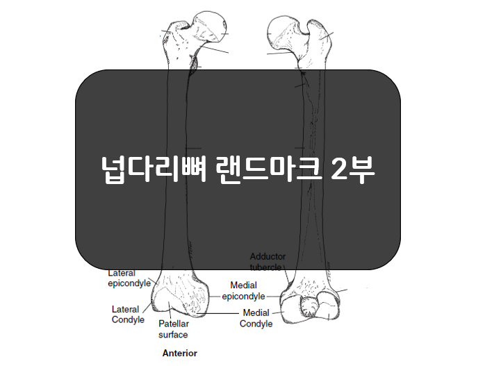  몸쪽 넙다리뼈 랜드마크(Femur Landmarks) 2부 - 큰돌기, 작은돌기, 거친선