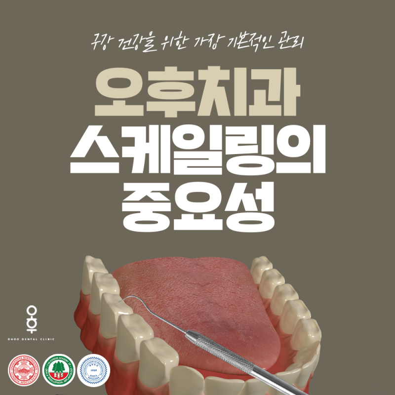 오금동치과추천/충치단계별 통증과 충치치료법