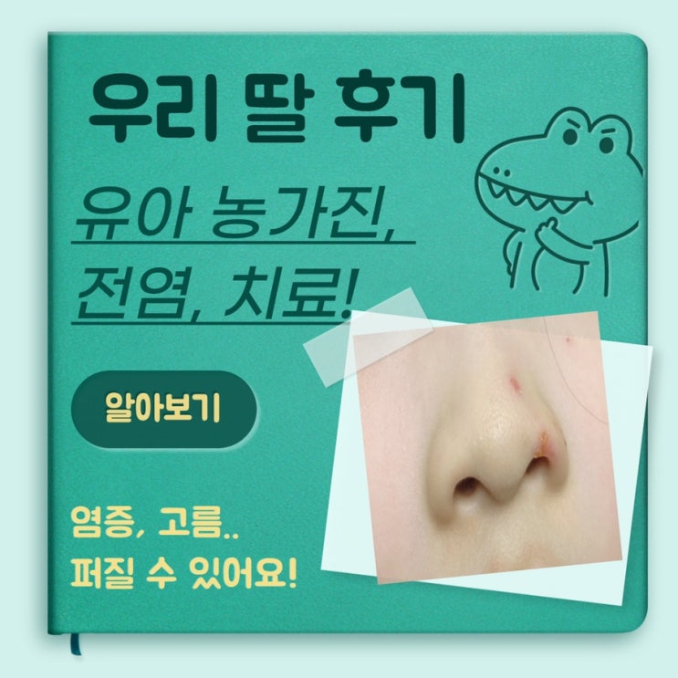  유아농가진 전염, 원인, 연고, 퍼지지 않게 하는 팁은?