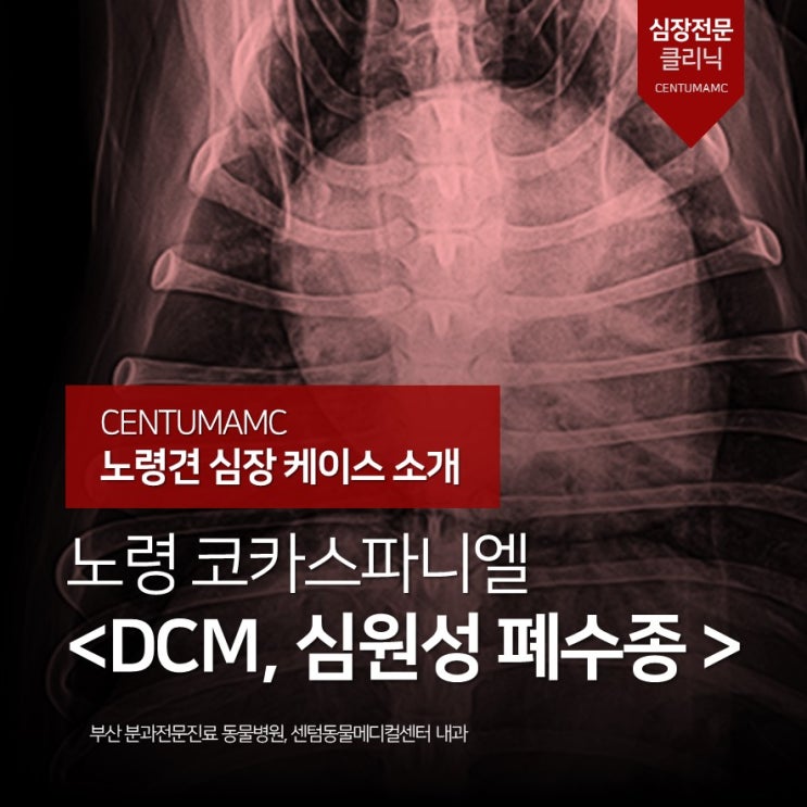  [노령견 심장 케이스 소개] 노령 코카스파니엘, DCM, 심원성 폐수종 (부산센텀AMC 심장 클리닉)