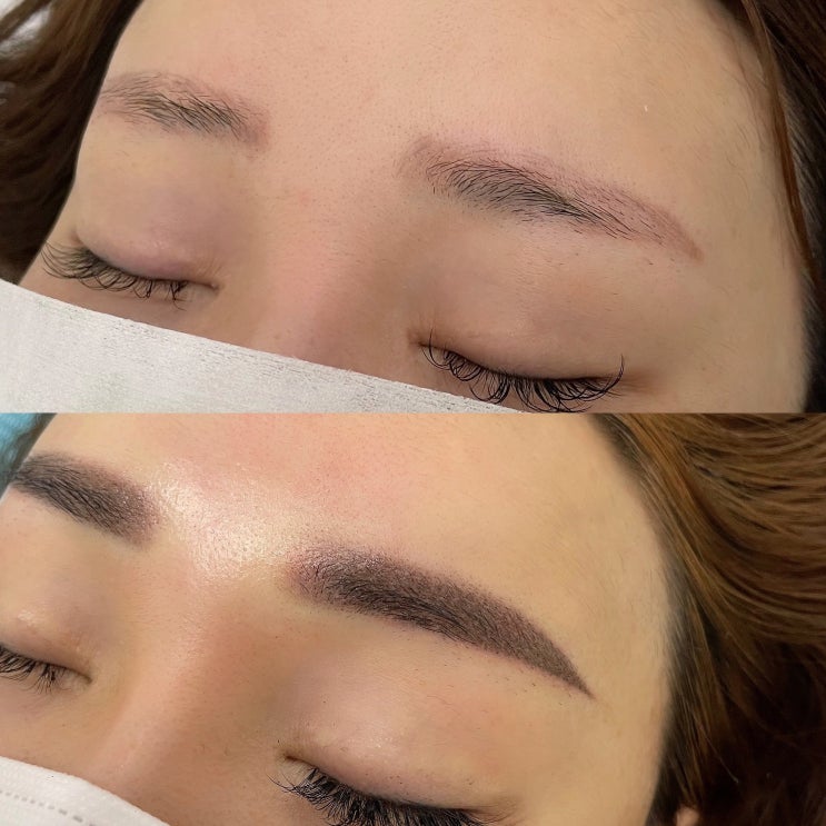  천안 눈썹문신:) 붉은상흔 붉은잔흔 잔흔제거 해결사!