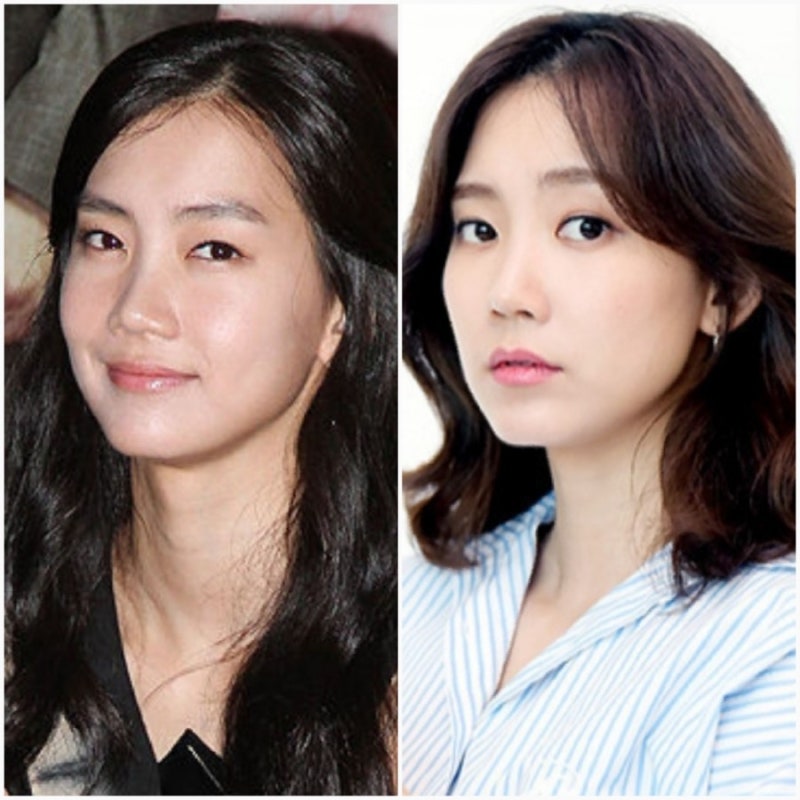 배우 신현빈 프로필 나이 키 본명 학력 슬의생 장겨울