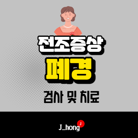  폐경 전조증상, 원인, 검사, 치료 알아보아요!