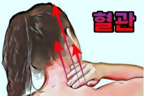 뒷머리 통증(왼쪽 오른쪽), 후두하근 4
