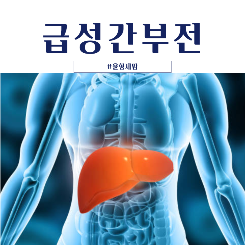 급성간부전 증상과 원인