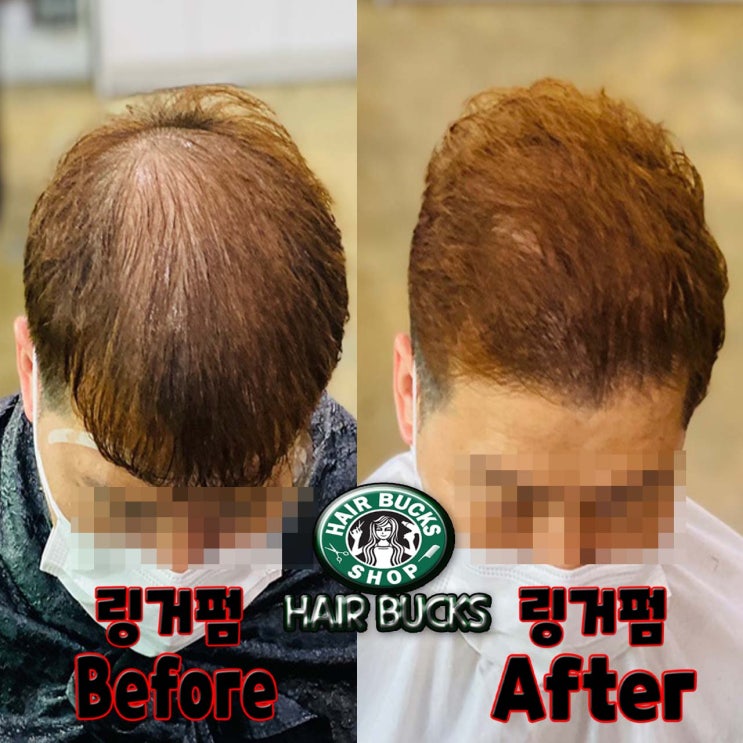  얇고 힘없는 머리 ! ! 숱많아 보이는 펌~!! 남자분들 펌하실땐 링거펌이 필수 입니다!! 수원정자동미용실 헤어벅스에서 탈모커버펌 하기 !!