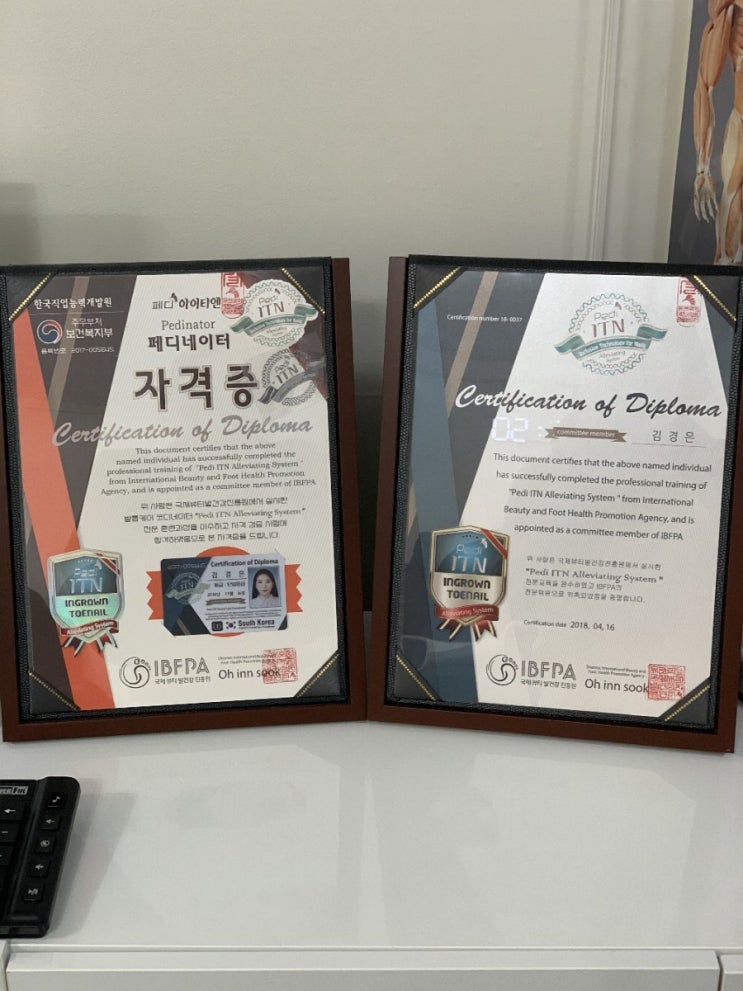  순천 파고드는발톱, 내향성발톱 꼼꼼한 더블유뷰티에서 발관리받은후기