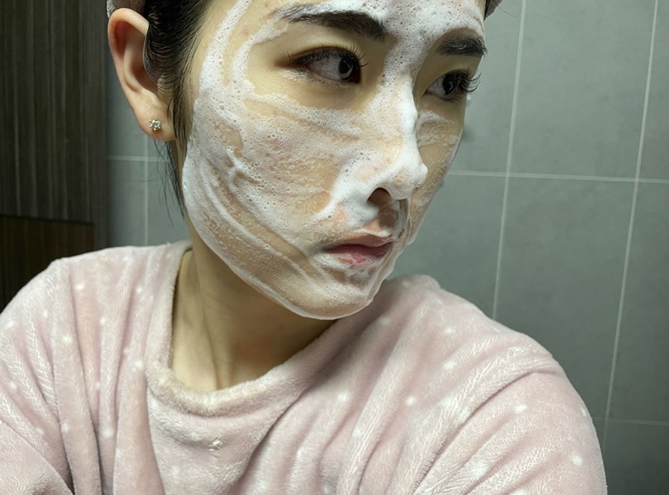  여드름 없애는법 찐후기 갑니다