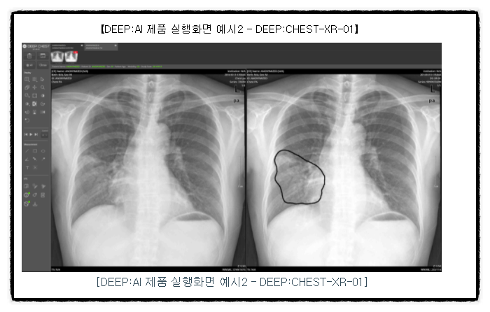 딥노이드 청약할까말까? 균등배정 비례배정 공모주 청약 2일차 오전 경쟁률 (기술성장기업 상장특례적용)+환매청구권 뜻