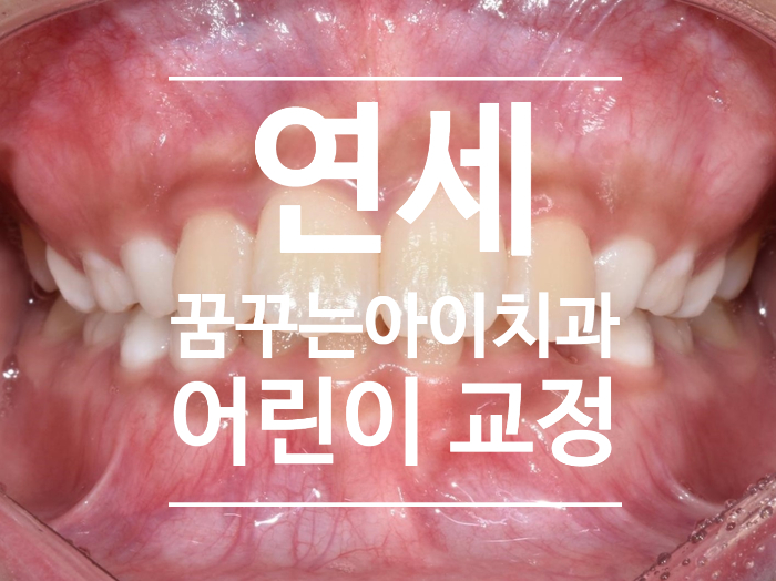 연세꿈꾸는아이치과에서 어린이 교정의 목표와 지향하는 결과, 바른 얼굴 만들기 프로젝트 연세꿈꾸는아이치과에서 어린이 교정의 목표와 지향하는 결과, 바른 얼굴 만들기 프로젝트