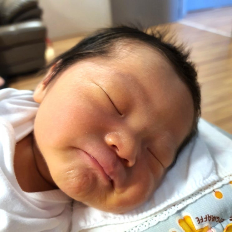  D+5 신생아황달 | 대구효성병원 본느마망에선 황달 치료가 무료?