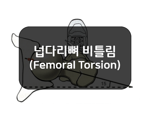  넙다리뼈 비틀림(Femoral Torsion) - 앞경사(Anteversion), 뒤경사(Retroversion)
