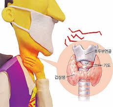  갑상샘총정리 구조기능 항진저하증비교 호르몬역할종류 갑상선암종양 그레이브스병 크레틴병