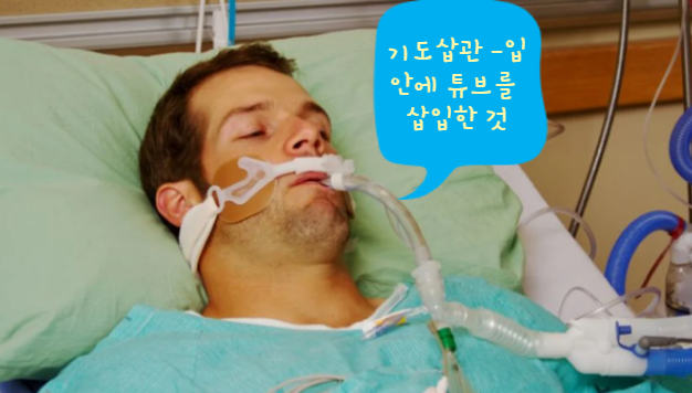  전신 마취할 때 기도삽관은 뭔가요?