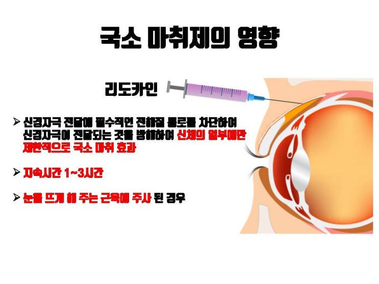  쌍수 후 눈이 덜 떠지는 것은 정상인가요? 아니면 쌍수 부작용인가요?