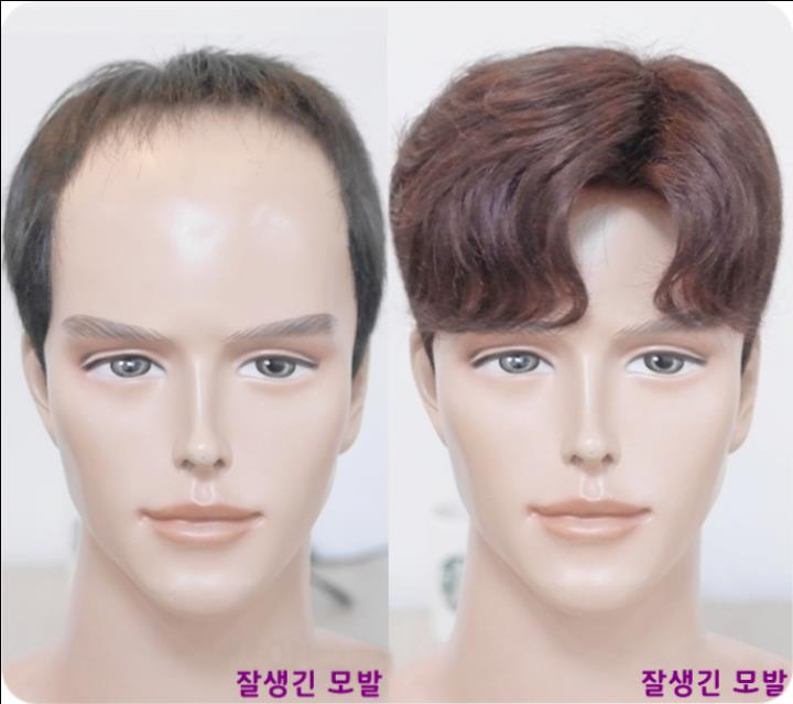  안양 분당 남자인모가발 잠실 송파 남성부분맞춤 성남