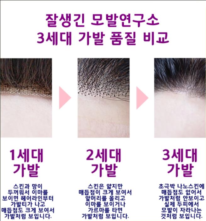  남자 헤어패치 생생정보통가발은 접착식일까