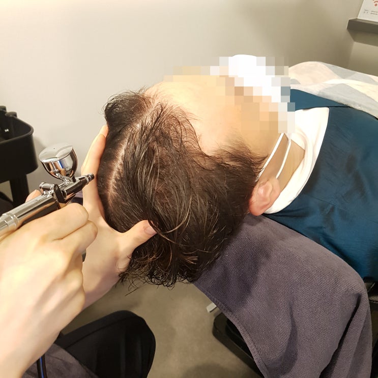  광명 두피 탈모 관리 닥터모락에서 예방 방법 대방출
