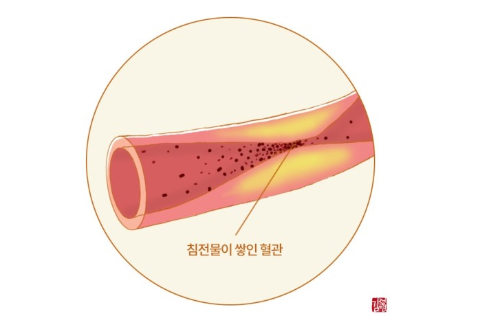  첫월급부모님선물로 너무좋은 폴리코사놀(콜레스테롤수치낮추기)
