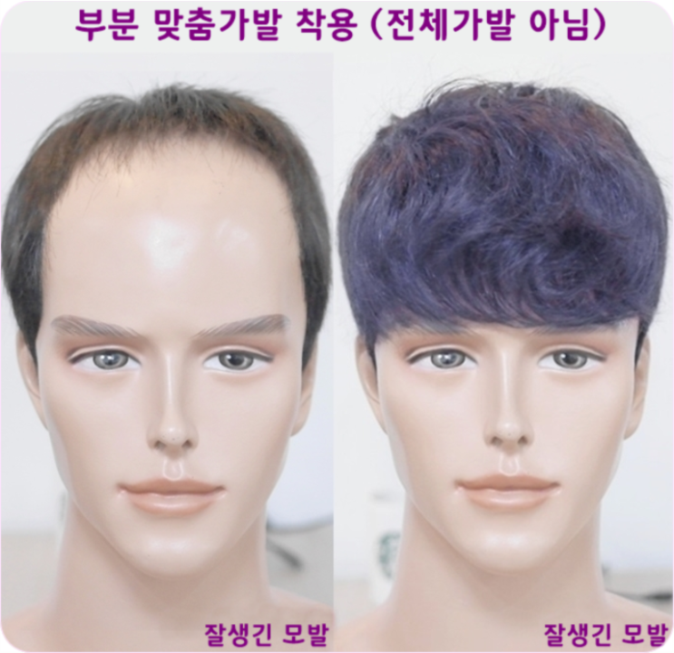 영등포가발로 분당과 의정부에서 M자 이마커버하러 오는