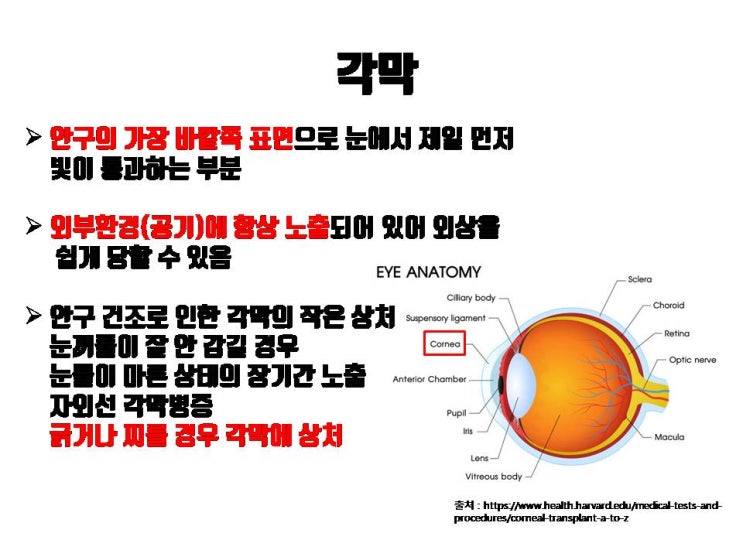  쌍수 시 드물지만 각막 손상 발생할 수 있어요. 쌍수 후 렌즈 바로 착용하지 말라는 이유죠.
