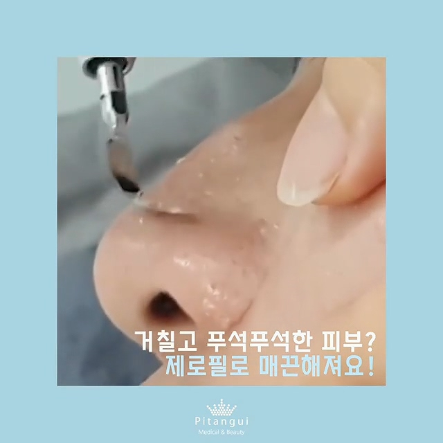  제로필 이벤트 각질·블랙헤드·모공청소 깔끔하게!