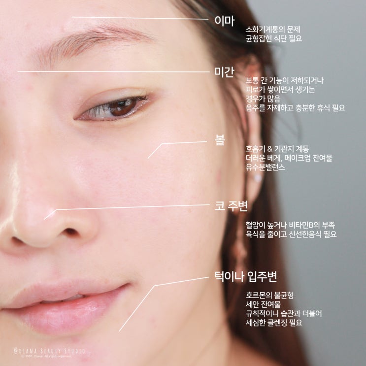 얼굴 여드름 부위별 원인과 세안제 알아보기 얼굴 여드름 부위별 원인과 세안제 알아보기
