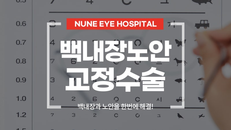 노안교정수술 연령 시기가 중요