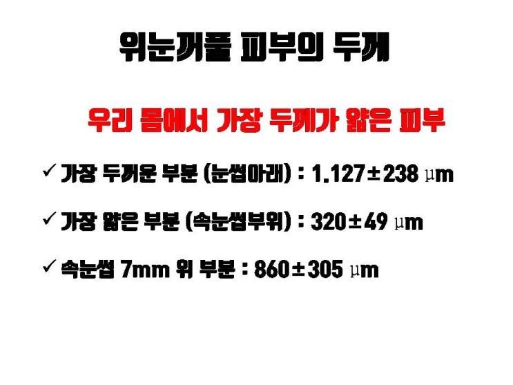  절개 쌍꺼풀 수술 후 한 참 지나도 쌍수 실밥 튀어 나올 수 있어요. 절대 스스로 뽑지 마세요!!!