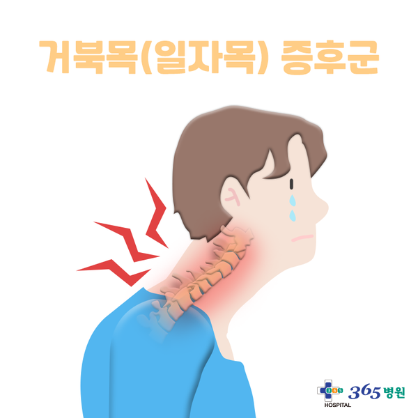  [창원마산 척추관절 디스크 365병원] 거북목증후군(일자목)