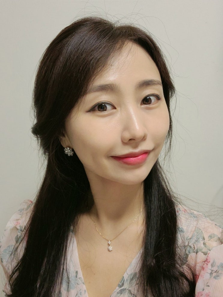  잠실역 피부과 쥬베룩 3cc 효과 후기