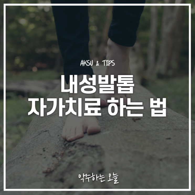  내성발톱 자가치료 어떻게 하면 될까 집에서 스스로 치료하는법 및 예방법 정리