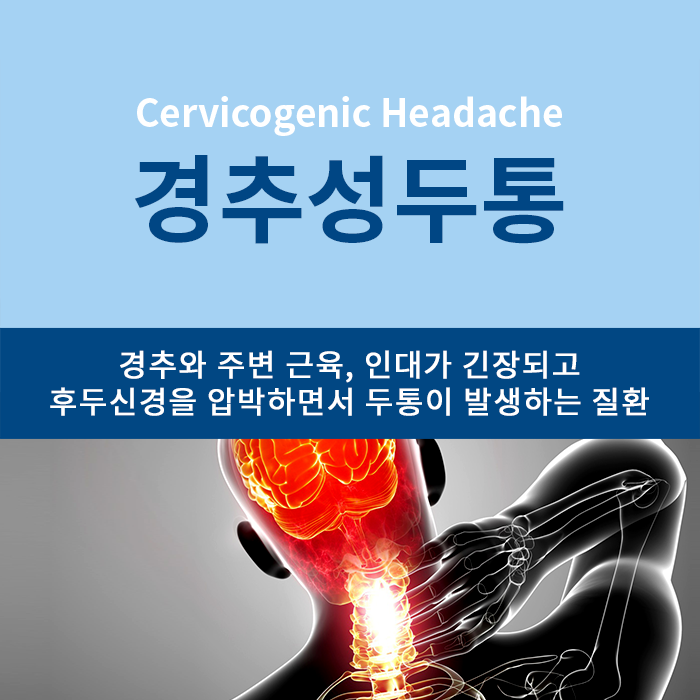 경추성 두통 원인은 잘못된 자세! (Cervicogenic Headache) : 네이버 블로그 경추성 두통 원인은 잘못된 자세! (Cervicogenic Headache) : 네이버 블로그