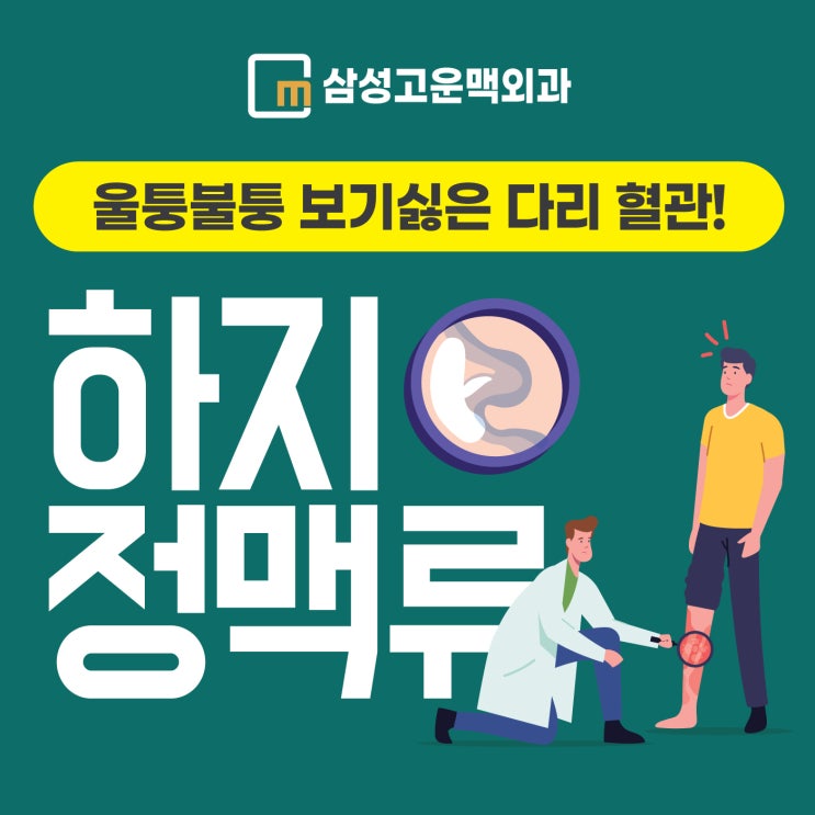 발산역하지정맥류, 효과적으로 치료 하려면?