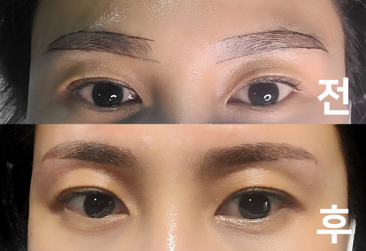  <브라질리언+눈썹>시원하게 다 뽑아버려!! 신논현왁싱 잘하는 곳