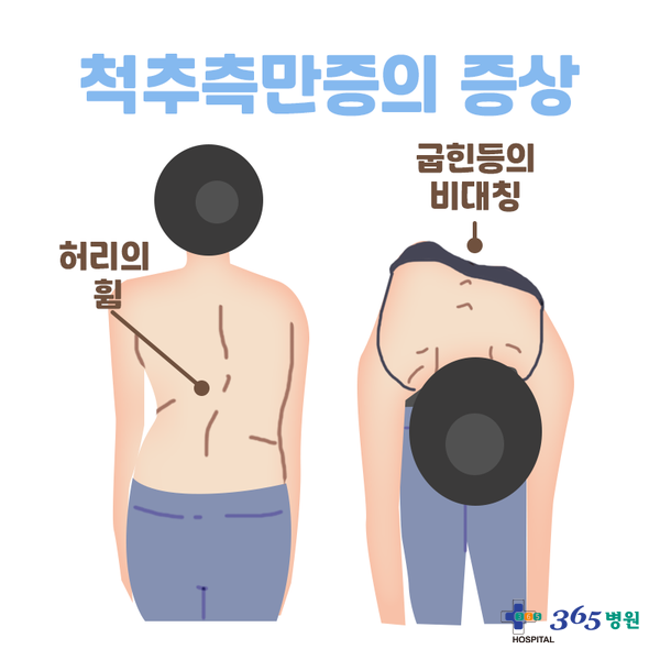 [창원마산 척추관절 디스크 365병원] 척추측만증 (척추 옆굽음증)