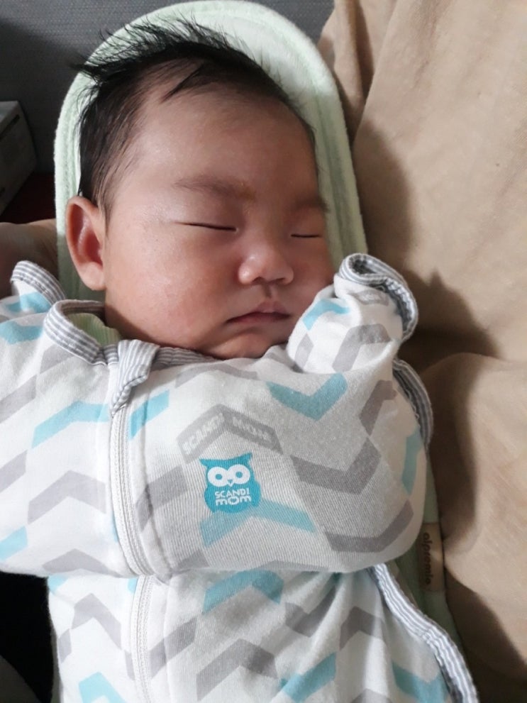  신생아 아기 얼굴태열 원인과 관리법