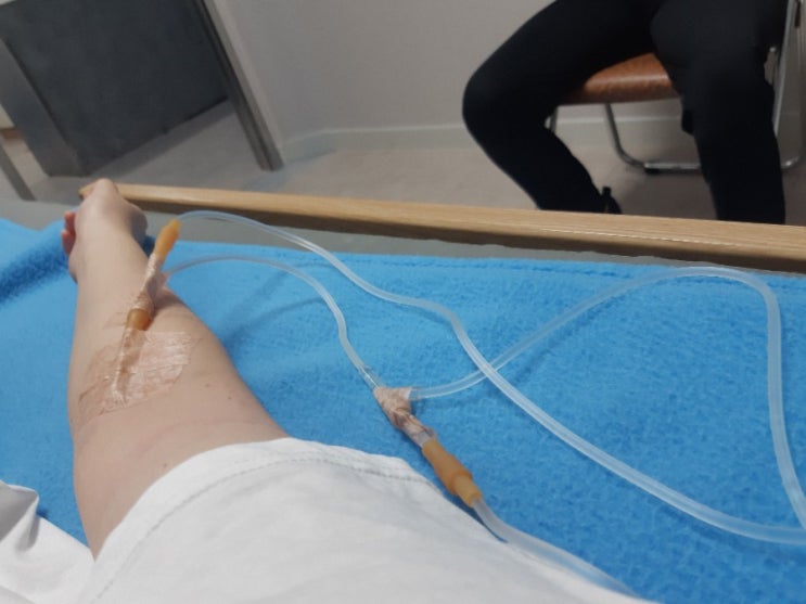  치질수술 염증 항문 부음 장염 설사 고열 몸살 후기