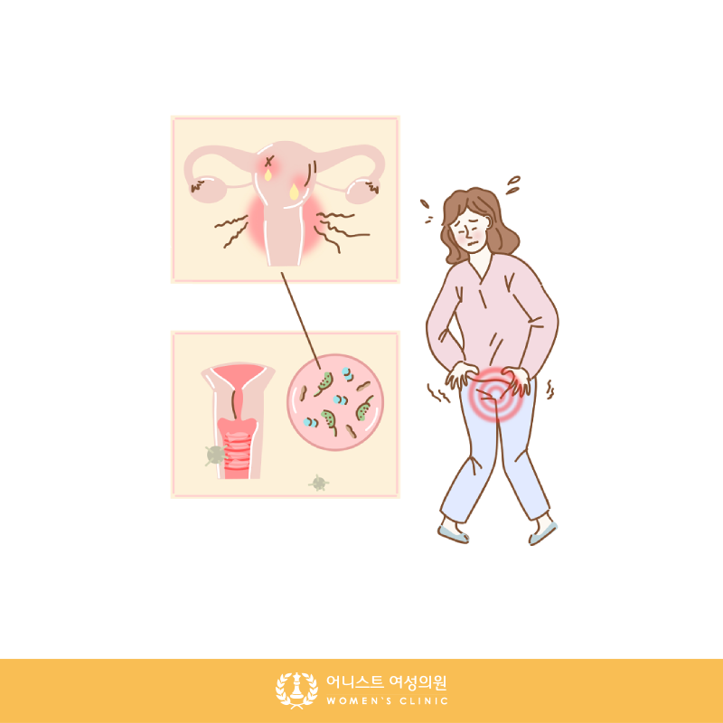 숭인동산부인과외음부종증 환경치료