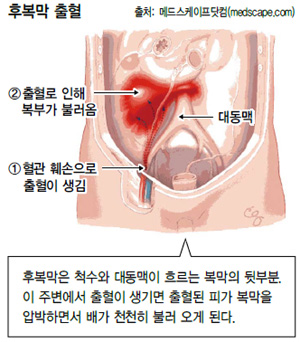  간호학 복강내출혈 원인병태생리 주요증상 교통사고TA 진단검사 치료간호중재 복막염쇼크합병증 문헌고찰