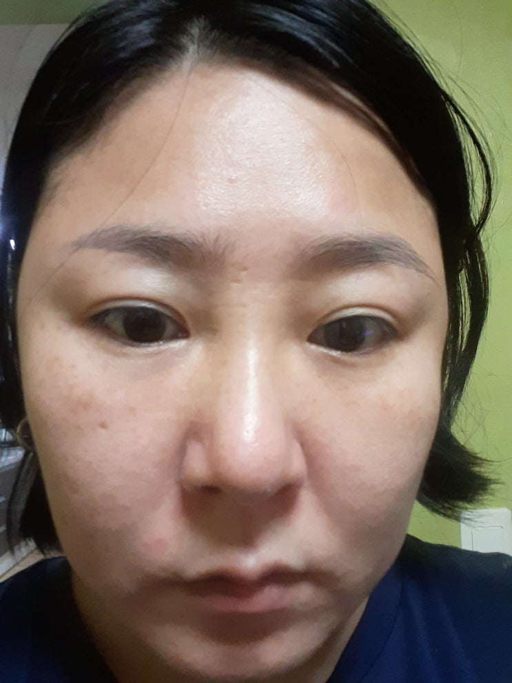  천연식초팩 3주 체험 후기