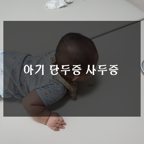  아기 단두증 사두증 알아보기