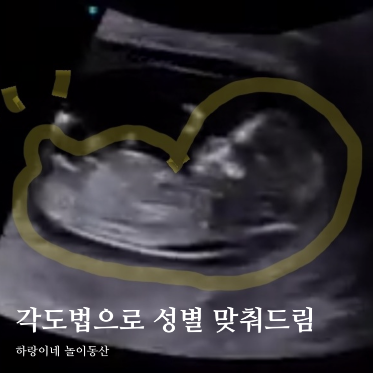  초음파사진 아들 딸 각도법 아기 성별 맞춰드려요