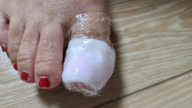 올리브영 젤네일 리무버 집에서 젤제거 젤패디 셀프 제거 수면 내시경 젤리무버 사용 후기