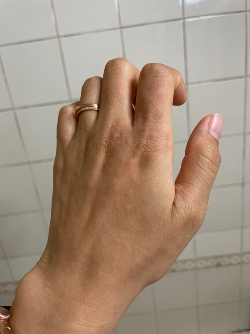 20대 여자 화이자 1차 백신 접종 부작용 두드러기, 붉은 반점, 가려움, 손 저림 : 네이버 블로그