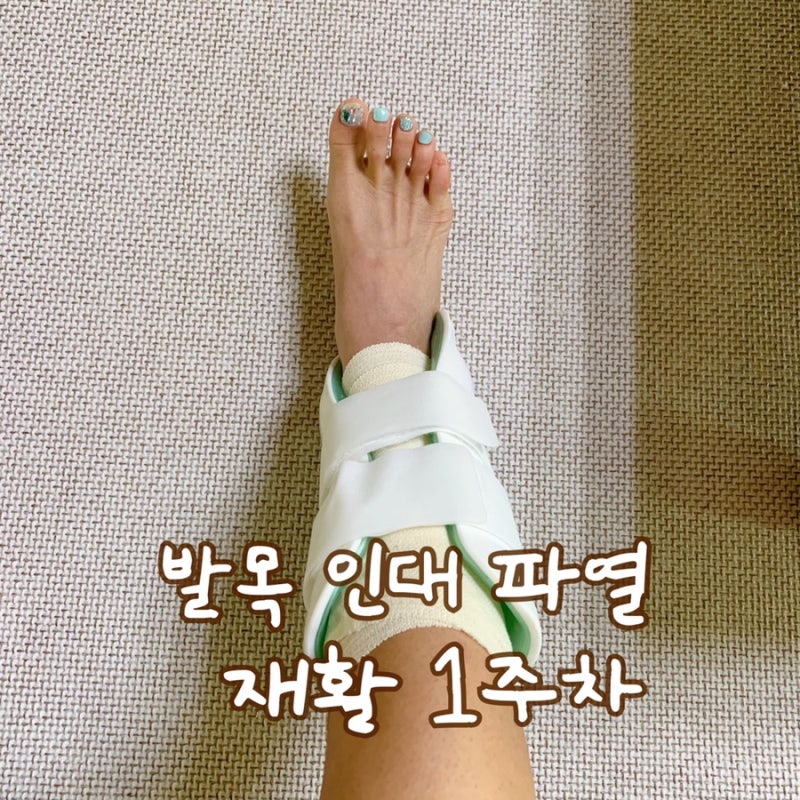 발목 인대 파열 비수술 보존적 치료에 도움 받은 방법 3가지 (우슬차, 호박즙, 시다스 깔창) 4