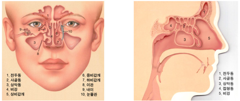 급성 부비동염 Acute sinusitis 부비동염, 축농증