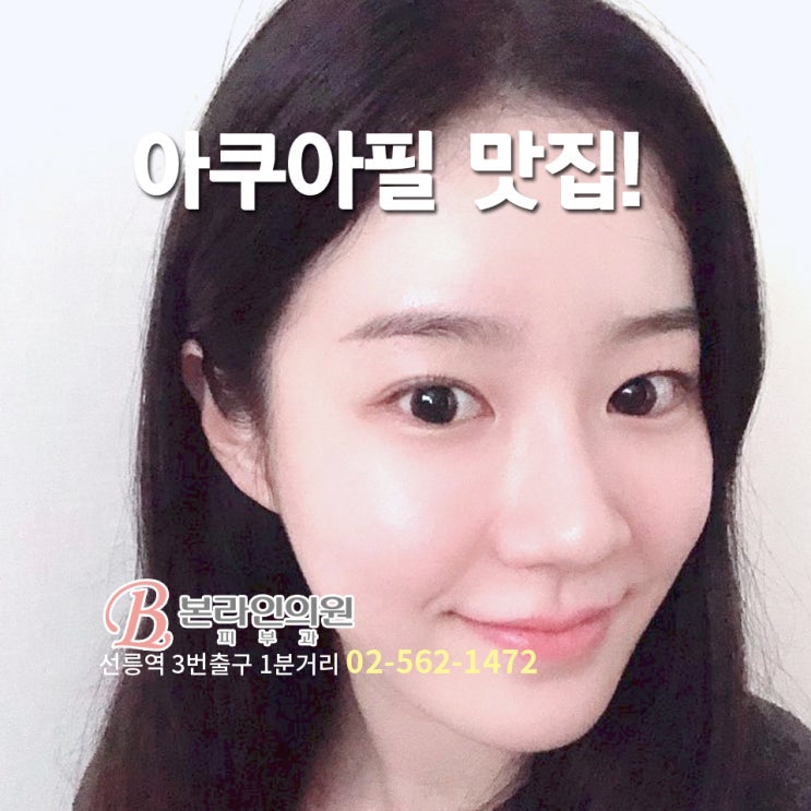  선릉피부과 아쿠아필가격, 아쿠아필모공청소, 모공축소, 아쿠아필주기